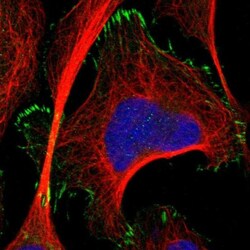 TMEM53 Antibody, Novus Biologicals:Antibodies:Primary Antibodies